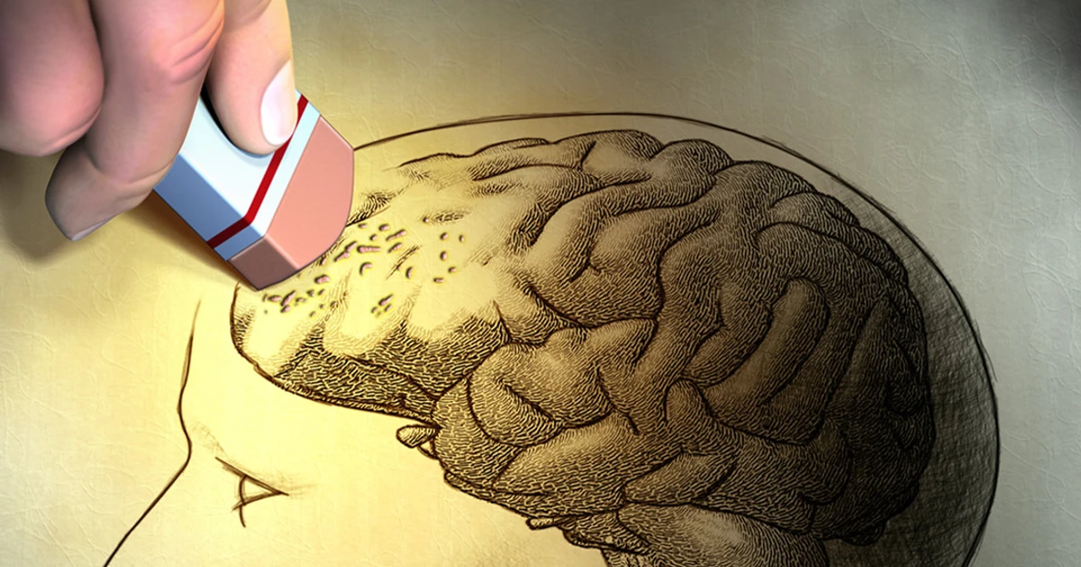 Erase Age-related Memory Loss - Memory Makeover
