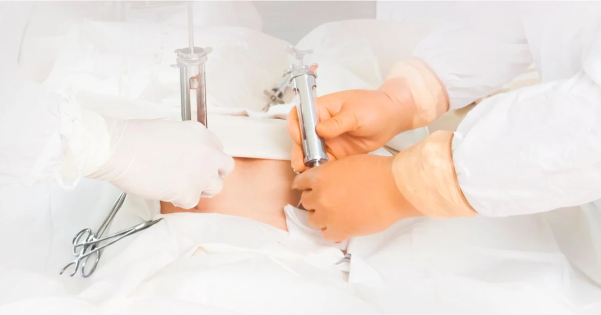 Navigating The Journey Understanding The Bone Marrow Transplant Process